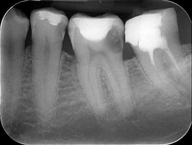 Zdjęcie zębów