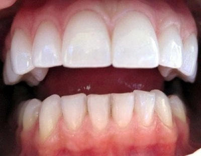 Zęby 006