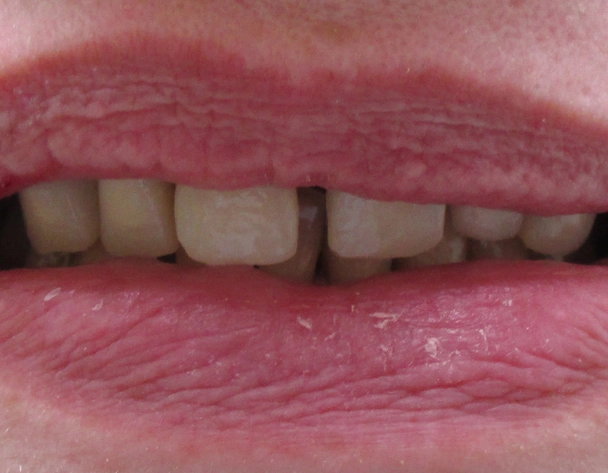 Zęby 001